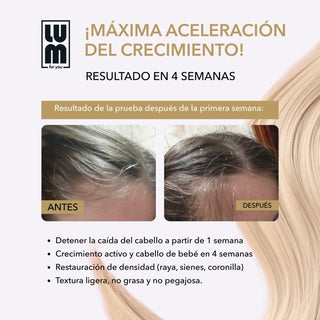 LUM HAIR LOTION FOR ACCELERATING HAIR GROWTH