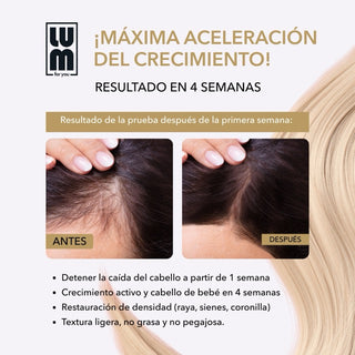 LUM HAIR LOTION FOR ACCELERATING HAIR GROWTH