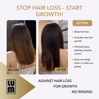 LUM HAIR LOTION FOR ACCELERATING HAIR GROWTH