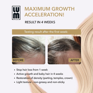 LUM HAIR LOTION FOR ACCELERATING HAIR GROWTH