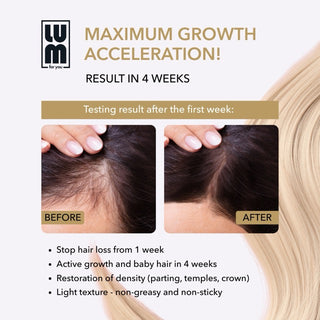 LUM HAIR LOTION FOR ACCELERATING HAIR GROWTH